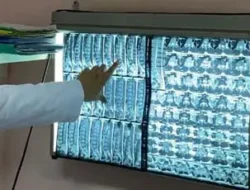 Kabar Baik, Masyarakat Tak Perlu Berobat Lagi ke Luar Negeri, Ada 4 Layanan Unggulan di RSUP Fatmawati Terkait Masalah 3 Hal Ini
